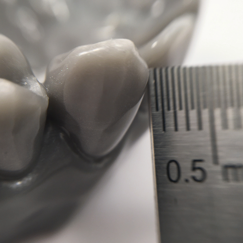 Zahnmedizin - Modell der Zahnrekonstruktion - Detail